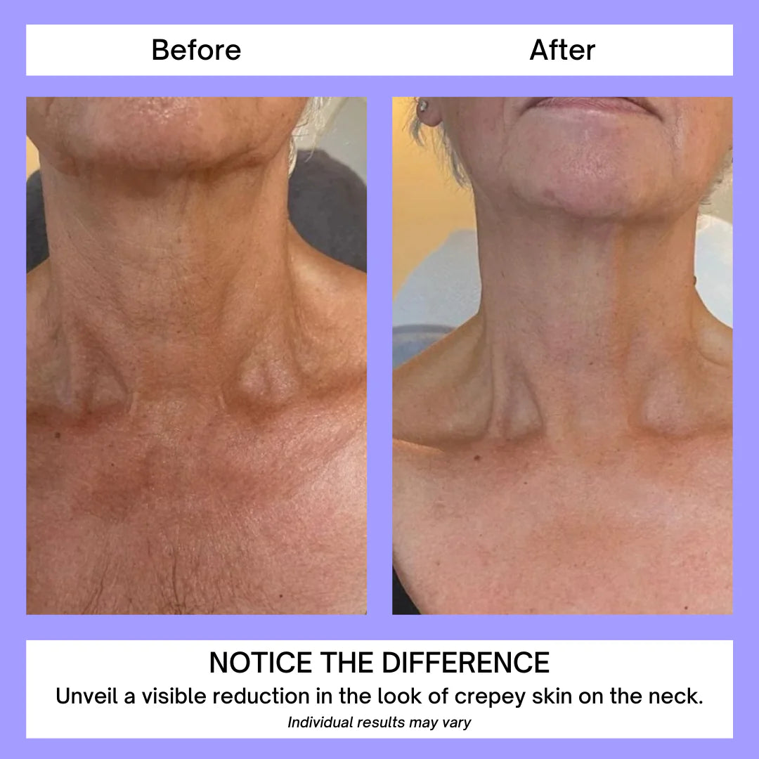 Tighten & Lift Neck Cream